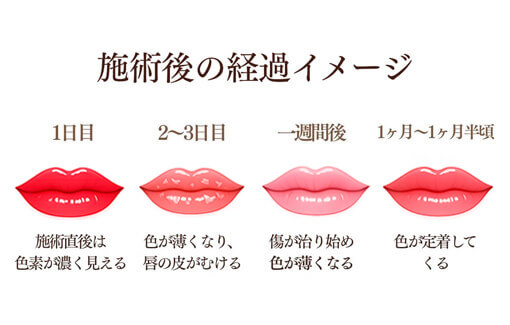 リップアートメイクのセルフケアと施術後の経過について