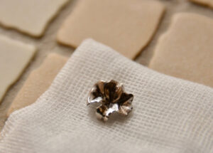 詰め物・被せ物が外れた